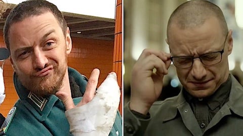 de la main cassée et enflée de Split, au plâtre d'Atomica Bionda